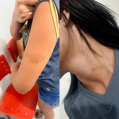 Vítima de violência doméstica em Manaína, na PB - Fotos: Reprodução
