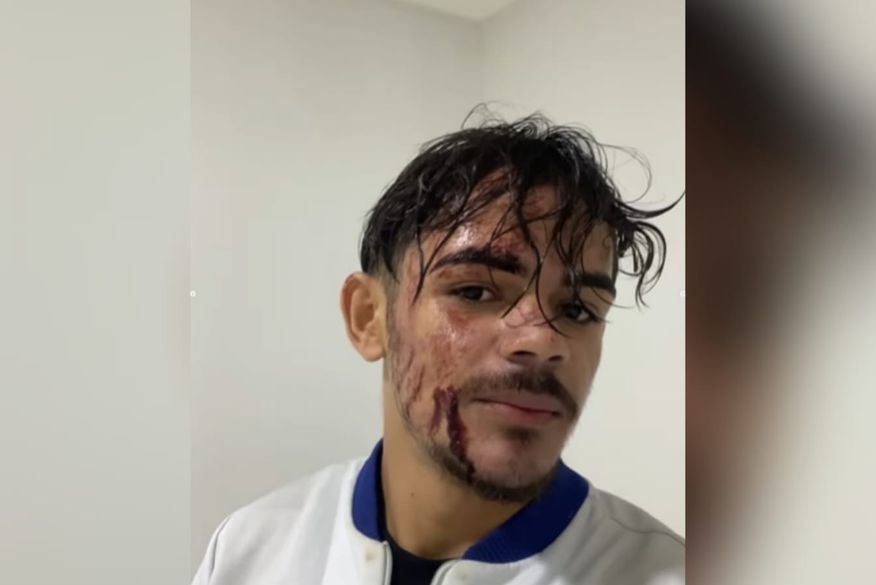 Elias Medeiros (Foto: redes sociais)