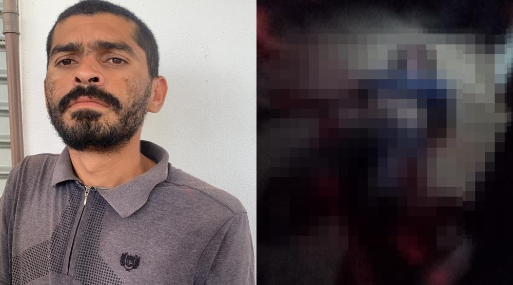 Vítima - Foto: Reprodução/Redes sociais