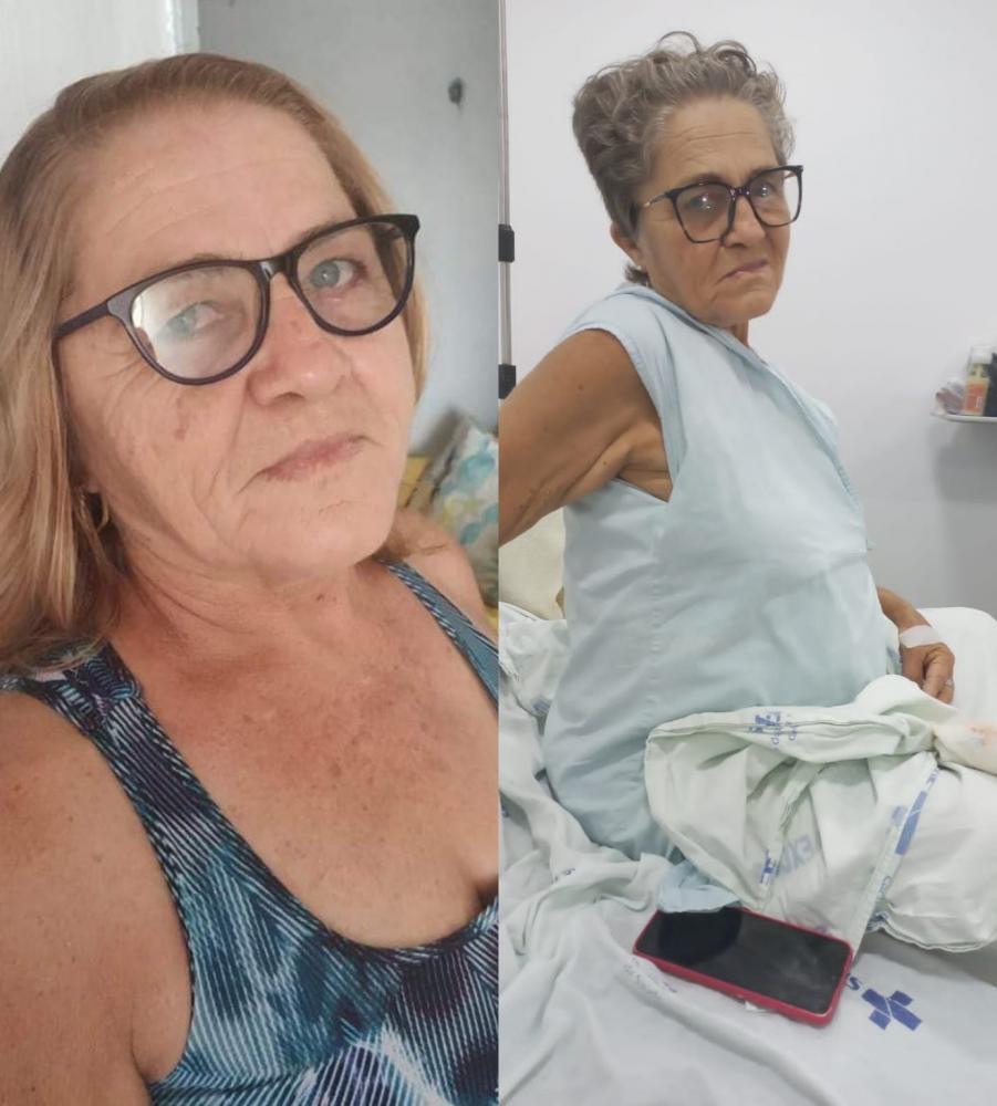 Graciene, antes e durante o tratamento