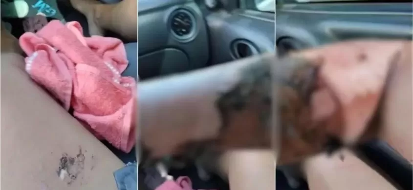 Imagens: Redes Sociais