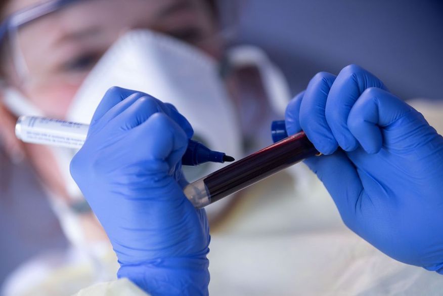 A ocupação total de leitos de UTI adulto em todo estado é de 26%. (Foto: Reprodução)